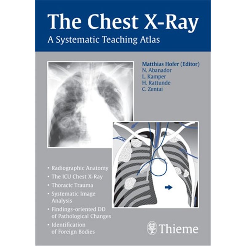 The Chest X-Ray - A Systematic Teaching Atlas